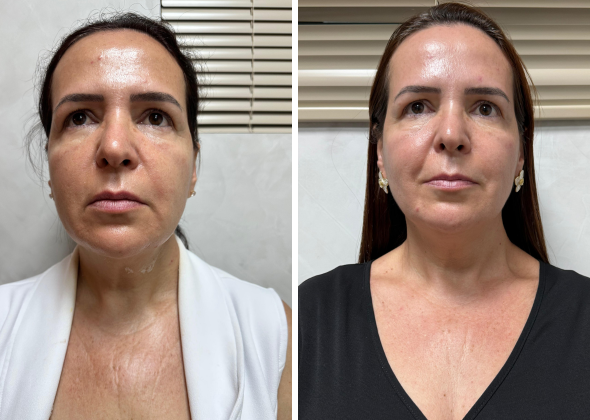 590 x 420 f4d 06 590 x 420 f4d 06